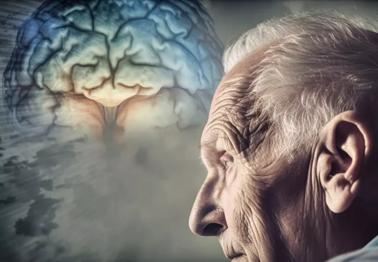 Alzheimer